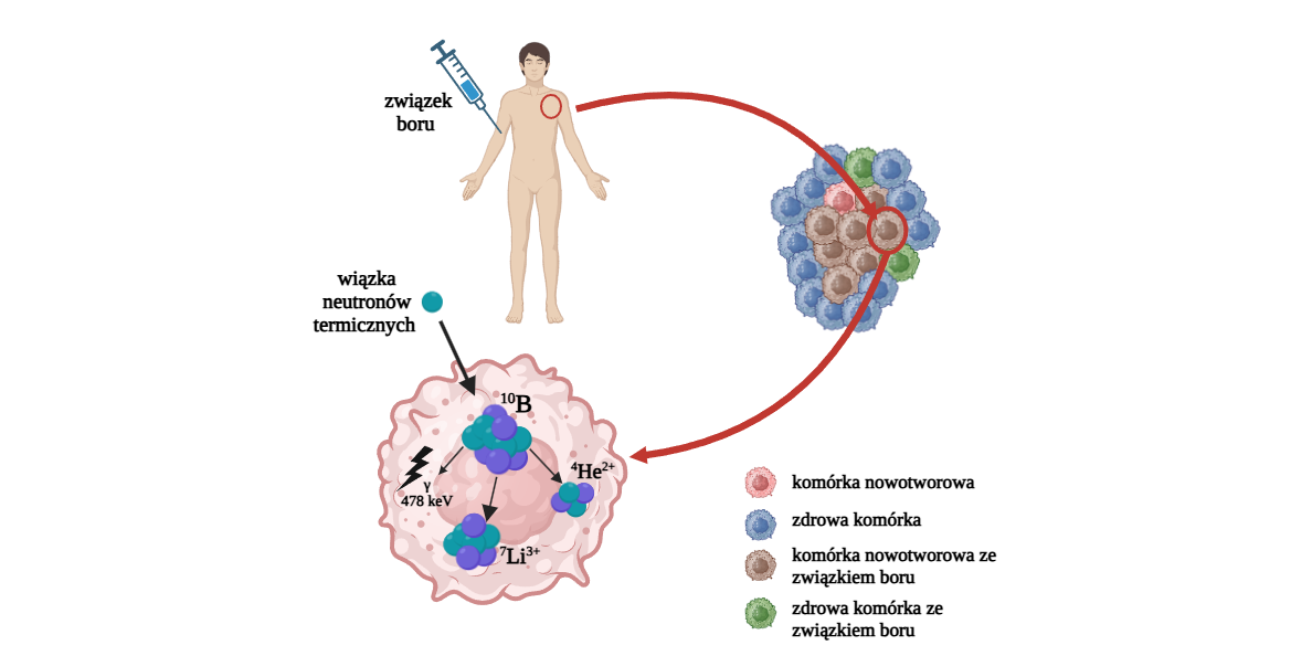 Schematyczne przedstawienie kolejnych etapów terapii borowo-neutronowej (BNCT): Źródło: https://www.sciencedirect.com/science/article/pii/S0969804325002210#fig1